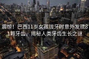 震驚！巴西11歲女孩拔牙時意外發(fā)現(xiàn)81顆牙齒，揭秘人類牙齒生長之謎